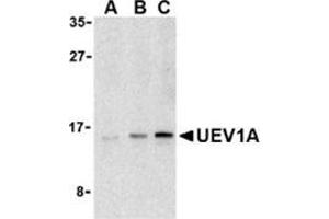 Western blot analysis of UEV1A in Jurkat cell lysates with this product at (A) 1, (B) 2, and (C) 4 μg/ml. (UBE2V1 抗体  (C-Term))