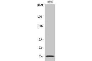 Western Blotting (WB) image for anti-Cytochrome P450, Family 2, Subfamily D, Polypeptide 6 (CYP2D6) (Internal Region) antibody (ABIN3184181) (CYP2D6 抗体  (Internal Region))