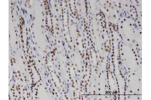 Immunoperoxidase of monoclonal antibody to DDX11 on formalin-fixed paraffin-embedded human kidney. (DDX11 抗体  (AA 1-970))