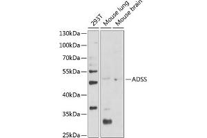 Western blot analysis of extracts of various cell lines, using ADSS Antibody (ABIN6131467, ABIN6136604, ABIN6136606 and ABIN6216015) at 1:1000 dilution. (ADSS 抗体  (AA 1-280))