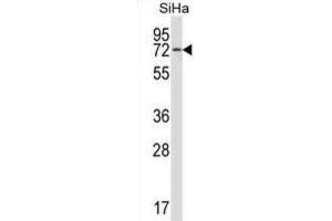 Western Blotting (WB) image for anti-Heat Shock 70kD Protein 12B (HSPA12B) antibody (ABIN2997411) (HSPA12B 抗体)
