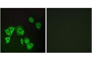 Immunofluorescence analysis of A549 cells, using TTF2 Antibody. (TTF2 抗体  (AA 51-100))