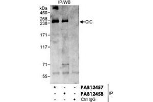 Detection of Human CIC/Capicua by Western blot and Immunoprecipitation. (CIC 抗体)