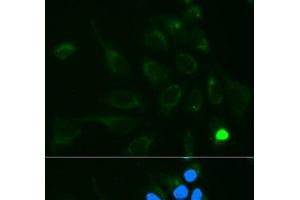 Immunofluorescence analysis of MCF-7 cells using UGT1A9 Polyclonal Antibody (UGT1A9 抗体)