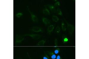 Immunofluorescence analysis of MCF-7 cells using UGT1A9 Polyclonal Antibody
