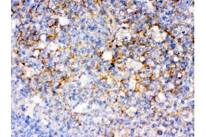 Immunohistochemistry (Paraffin-embedded Sections) (IHC (p)) image for anti-CD14 (CD14) (AA 65-327) antibody (ABIN3044565)