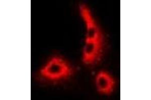 Immunofluorescent analysis of Dermcidin staining in MCF7 cells. (Dermcidin 抗体)