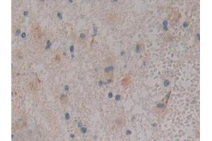 Immunohistochemistry (IHC) image for anti-Polycystic Kidney Disease 1 (Autosomal Dominant) (PKD1) antibody (ABIN7442792)