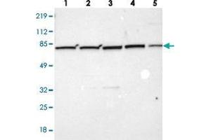 Western blot analysis of Lane 1: Human cell line RT-4, Lane 2: Human cell line U-251MG sp, Lane 3: Human cell line A-431, Lane 4: Human liver tissue, Lane 5: Human tonsil tissue with ZC3H12B polyclonal antibody .