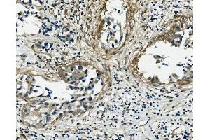 IHC analysis of VCL using anti-VCL antibody (ABIN7599003). (Vinculin 抗体  (AA 1-149))