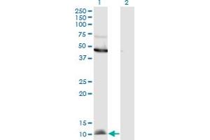 Western Blot analysis of CCL2 expression in transfected 293T cell line by CCL2 monoclonal antibody (M11), clone 3H7. (CCL2 抗体  (AA 1-99))