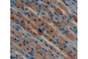 Used in DAB staining on fromalin fixed paraffin- embedded Kidney tissue (NUAK1 抗体  (AA 404-651))