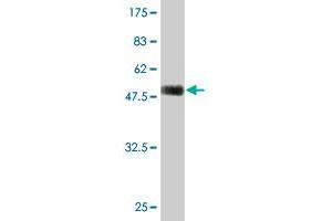 Western Blot detection against Immunogen (51. (TGIF2 抗体  (AA 1-237))