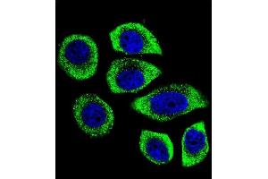 Confocal immunofluorescent analysis of PIP5KL1 Antibody (N-term) (ABIN655244 and ABIN2844847) with U-251MG cell followed by Alexa Fluor 488-conjugated goat anti-rabbit lgG (green). (PIP5KL1 抗体  (N-Term))