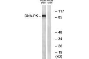 Western blot analysis of extracts from mouse brain cells, using Dynamin-1 (Ab-774) Antibody. (Dynamin 1 抗体  (AA 740-789))