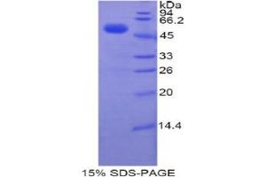 SDS-PAGE analysis of Human TFAM Protein. (TFAM 蛋白)