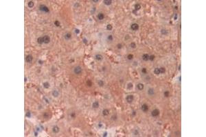 IHC-P analysis of Human Tissue, with DAB staining. (MT1E 抗体  (AA 1-61))