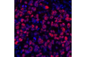 Immunofluorescence (IF) image for anti-SRY (Sex Determining Region Y)-Box 10 (SOX10) (AA 416-466) antibody (ABIN7455186) (SOX10 抗体  (AA 416-466))