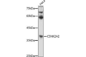 Western blot analysis of extracts of HeLa cells, using CSNK2 antibody (ABIN3022252, ABIN3022253, ABIN3022254 and ABIN6218695) at 1:1000 dilution. (CSNK2A2 抗体  (AA 1-350))