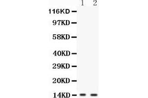 Anti-FABP6 antibody, Western blottingAll lanes: Anti FABP6  at 0. (FABP6 抗体  (N-Term))