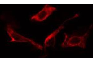 ABIN6266758 staining NIH-3T3 cells by IF/ICC. (MAN1B1 抗体  (Internal Region))