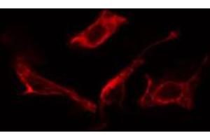 ABIN6266758 staining NIH-3T3 cells by IF/ICC. (MAN1B1 抗体  (Internal Region))