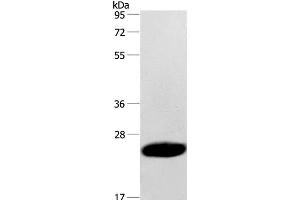 Western Blot analysis of Human fetal muscle tissue using CAV3 Polyclonal Antibody at dilution of 1:500 (Caveolin 3 抗体)