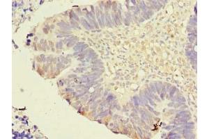 Immunohistochemistry (IHC) image for anti-Transmembrane Protein 59-Like (TMEM59L) (AA 27-267) antibody (ABIN7173249)