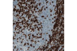 Immunohistochemical staining (Formalin-fixed paraffin-embedded sections) of human tonsil with CD3E monoclonal antibody, clone CL1497  shows strong positivity in a subset of lymphoid cells. (CD3 epsilon 抗体  (AA 25-126))