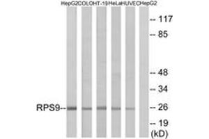 Western blot analysis of extracts from HepG2/COLO/HT-29/HeLa/HuvEc cells, using RPS9 Antibody. (RPS9 抗体  (AA 31-80))