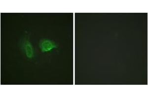 Immunofluorescence analysis of HeLa cells, using Calcium Sensing Receptor (Phospho-Thr888) Antibody. (CASR 抗体  (pThr888))
