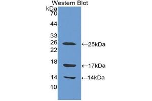 Detection of Recombinant CAMP, Human using Polyclonal Antibody to Cathelicidin Antimicrobial Peptide (CAMP) (Cathelicidin 抗体  (AA 31-170))