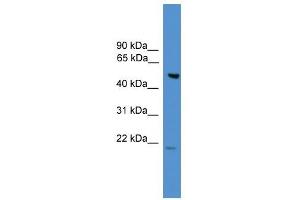 anti-Amyotrophic Lateral Sclerosis 2 (Juvenile) Chromosome Region, Candidate 12 (ALS2CR12) (N-Term) antibody