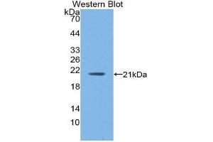 Western Blotting (WB) image for anti-Hemoglobin, alpha 1 (HBA1) (AA 1-142) antibody (ABIN1859123)