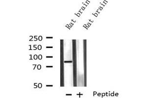 Western blot analysis on Rat brain lysate using CPT1C-specific antibody (CPT1C 抗体)