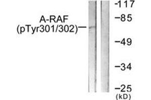 Western blot analysis of extracts from HeLa cells treated with PMA 125ng/ml 30', using A-RAF (Phospho-Tyr302) Antibody.