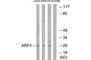 Western blot analysis of extracts from LOVO/K562/HT-29 cells, using ARF4 Antibody.