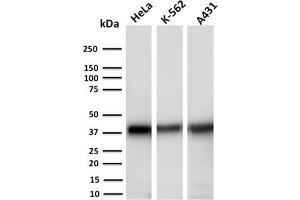 Western Blot Analysis of Human HeLa, K-562 and A431 cell lysates using AKR1C2 Mouse Monoclonal Antibody (CPTC-AKR1C2-1). (AKR1C2 抗体)