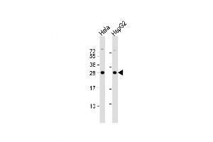 Western Blot at 1:1000 dilution Lane 1: Hela whole cell lysate Lane 2: HepG2 whole cell lysate Lysates/proteins at 20 ug per lane. (PMM2 抗体  (C-Term))