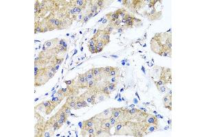 Immunohistochemistry of paraffin-embedded human gastric using PSTPIP1 antibody at dilution of 1:100 (x40 lens). (PSTPIP1 抗体)