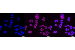 Immunocytochemical staining of HepG2 cells with RBMXL2 antibody (ABIN7800965), 1:1,000).