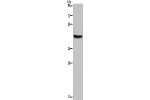 Western Blotting (WB) image for anti-Hydroxy-delta-5-Steroid Dehydrogenase, 3 beta- and Steroid delta-Isomerase 1 (HSD3B1) antibody (ABIN2430265) (HSD3B1 抗体)