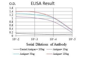 Black line: Control Antigen (100 ng), Purple line: Antigen(10 ng), Blue line: Antigen (50 ng), Red line: Antigen (100 ng), (ROCK1 抗体)