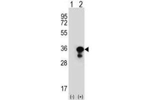Western blot analysis of PCNA antibody and 293 cell lysate (2 ug/lane) either nontransfected (Lane 1) or transiently transfected (2) with the PCNA gene. (PCNA 抗体  (AA 231-261))