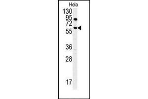 Image no. 1 for anti-anthrax Toxin Receptor 1 (ANTXR1) (AA 365-394), (Tyr382) antibody (ABIN360040) (ANTXR1 抗体  (Tyr382))