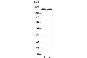 Western blot testing of nNOS antibody and Lane 1:  rat brain;  2: MCF-7;  Predicted size: 160KD;  Observed size: 160KD (NOS1 抗体  (C-Term))