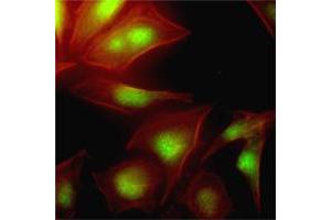 Immunofluorescence of human HeLa cells stained with Phalloidin-TRITC (Red) for Actin staining and UBE2S monoclonal antibody, clone AT2C12  (1 : 500) with Alexa 488 (Green). (UBE2S 抗体  (AA 1-222))