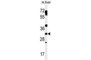 Western blot analysis of TBCD7 Antibody (Center) in mouse liver tissue lysates (35µg/lane).