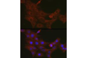 Immunofluorescence analysis of PC-12 cells using TR antibody (ABIN3023477, ABIN3023478, ABIN3023479 and ABIN6220053) at dilution of 1:50. (TRAF7 抗体)