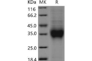 Western Blotting (WB) image for Killer Cell Lectin-Like Receptor Subfamily C, Member 1 (KLRC1) protein (His tag) (ABIN7320130) (KLRC1 Protein (His tag))